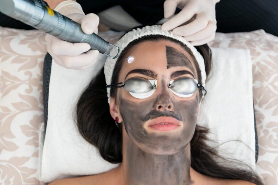 Carbon Peel laser- Neck