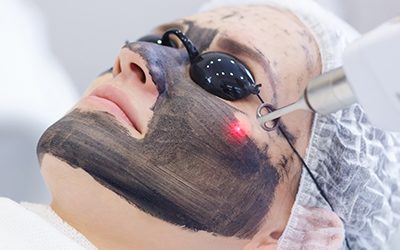 Carbon Peel: A Revolutionary Treatment With Accurate Results, With Aesthetya Spa
