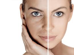 Pigmentation Melasma Treatment – Per Session