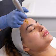 Mesotherapy